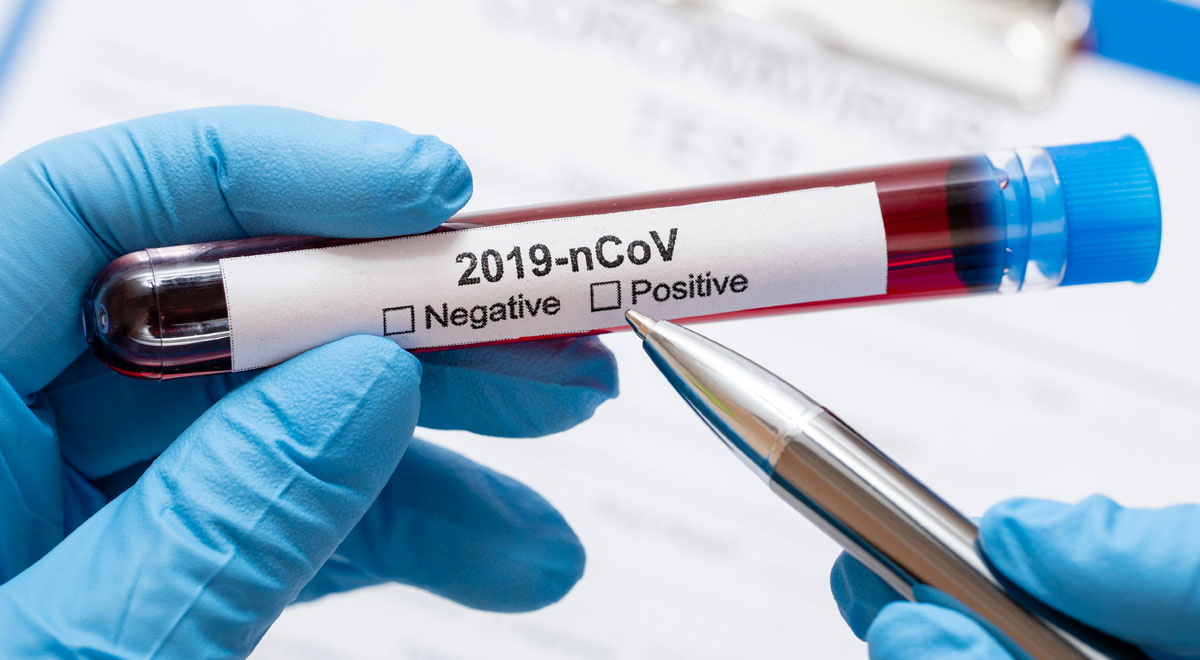 Coronavirus-Test / Foto: freepik